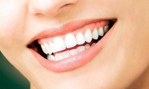 Cải thiện hàm răng đẹp hơn sau khi bọc răng sứ Cai-thien-ham-rang-dep-hon-sau-khi-boc-rang-su